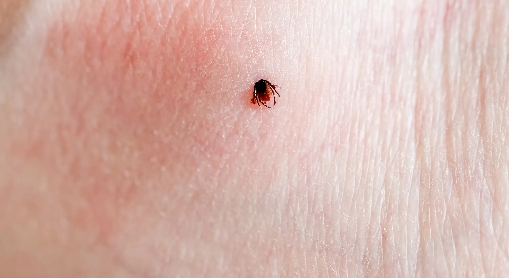 Achtung Zecken – Schutz, Entfernung und wichtige Hinweise